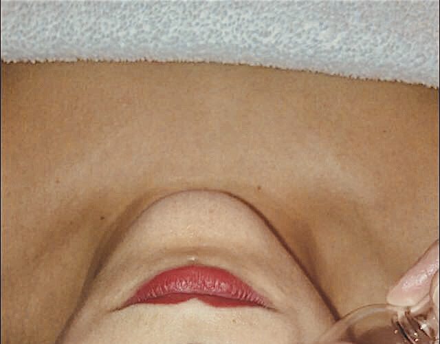 Facial Cupping Chi Spa