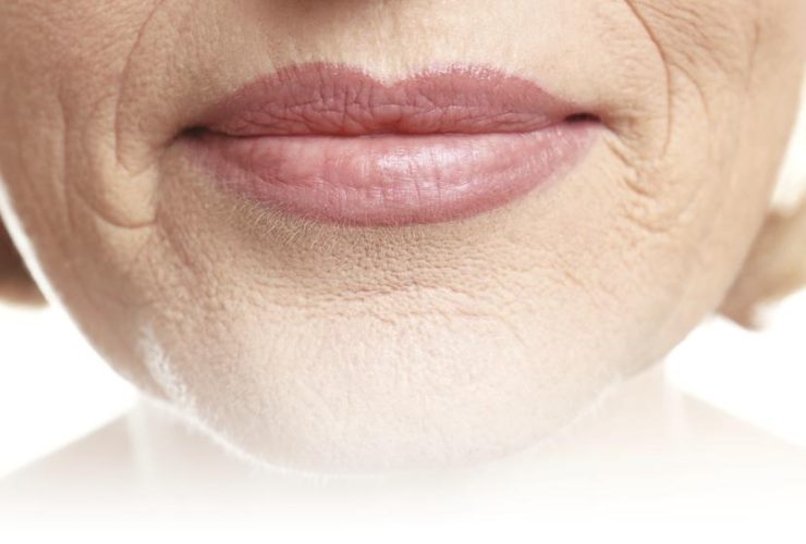 Arrugas, Algo Más Que La Huella Del Tiempo 54 Arrugas