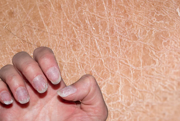 Hierro En Estética: Piel, Cabello Y Uñas Fuertes