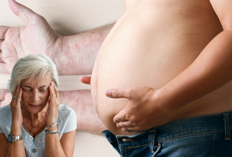 Alimentación Para Evitar La Inflamación
