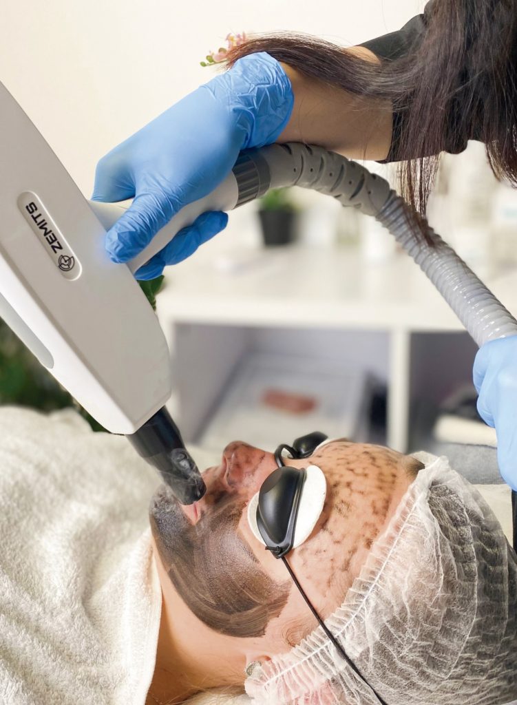 Eliminación De Tatuajes. Beneficios Y Oportunidades De Negocio 3 Eliminación De Tatuajes