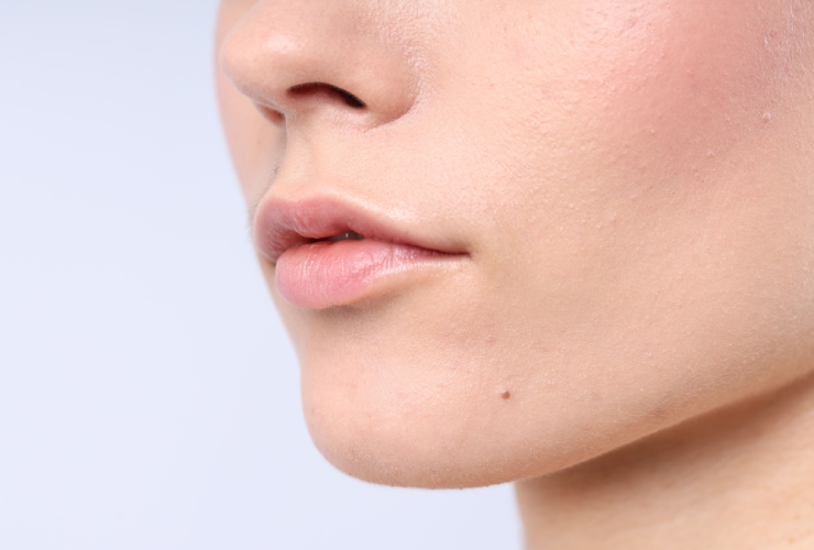 Piel Normal, ¿Es Lo Mismo Que Piel Mixta? 42 Piel Normal Rutina