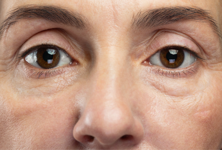 ¿Qué Es El Estrés Oxidativo Y Cómo Afecta A Nuestra Piel? 30 Qué Es El Estrés Oxidativo