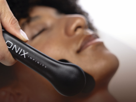 Onix Infinity: El Equipo Que Nunca Quiso Ser Convencional 23 Onix Infinity