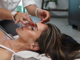 La Medicina Estética: Equilibrio Entre Ciencia, Belleza Y Bienestar 15 Phphjcfjh6A041F7Bd8A94