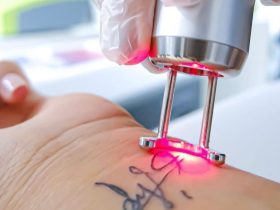 Láser Q-Switched: Una Tecnología Versátil Para Ampliar Tratamientos En Centros De Estética Avanzada 12 Diseno Sin Titulo 6