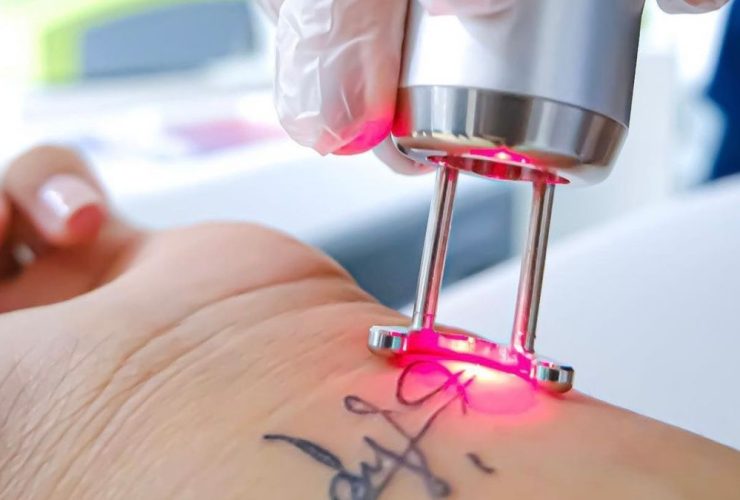 Láser Q-Switched: Una Tecnología Versátil Para Ampliar Tratamientos En Centros De Estética Avanzada 30 Diseno Sin Titulo 6