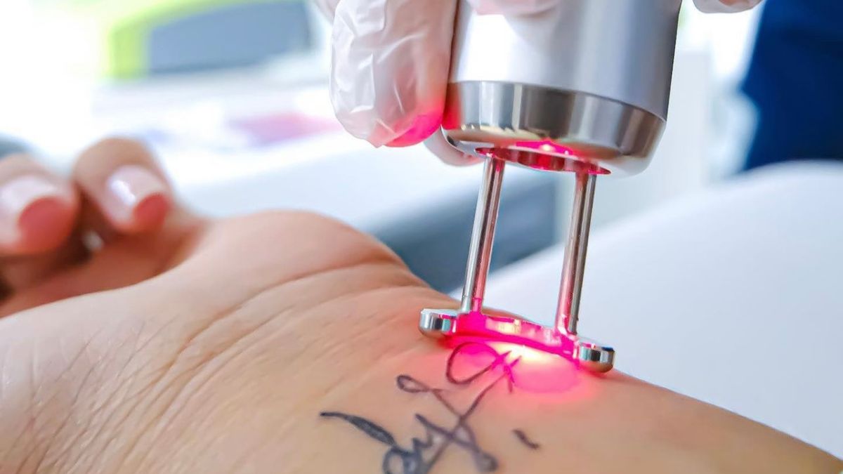 Láser Q-Switched: Una Tecnología Versátil Para Ampliar Tratamientos En Centros De Estética Avanzada 1 Diseno Sin Titulo 6